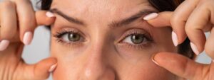 Blefaroplastyka Bielenda