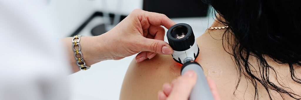 Dermatologia I Dermatochirurgia