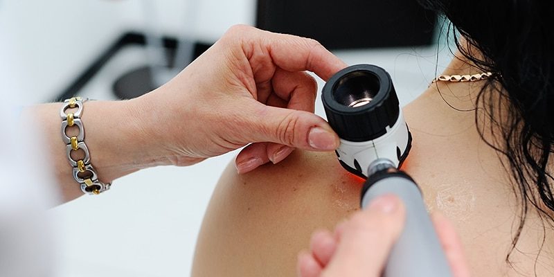 Dermatologia I Dermatochirurgia