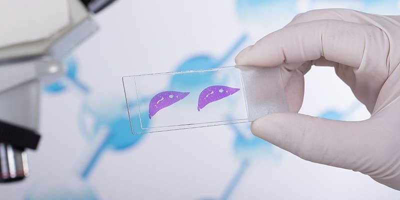 Biopsja