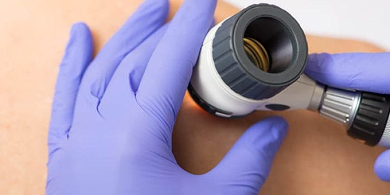 Instytut Bielenda Dermatologia I Dermatochirurgia