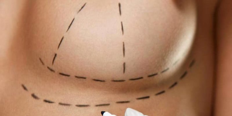 Instytut Bielenda Liposukcja I Powiekszanie Piersi