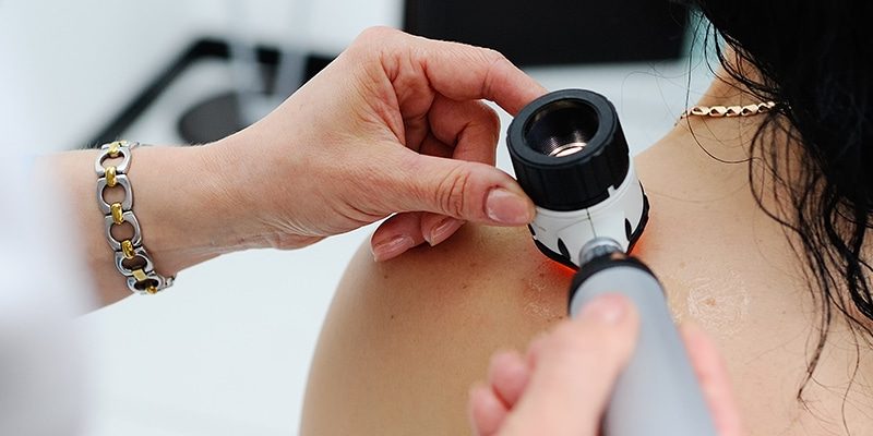 Konsultacje dermatologiczne