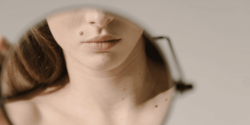 Videodermatoskopia